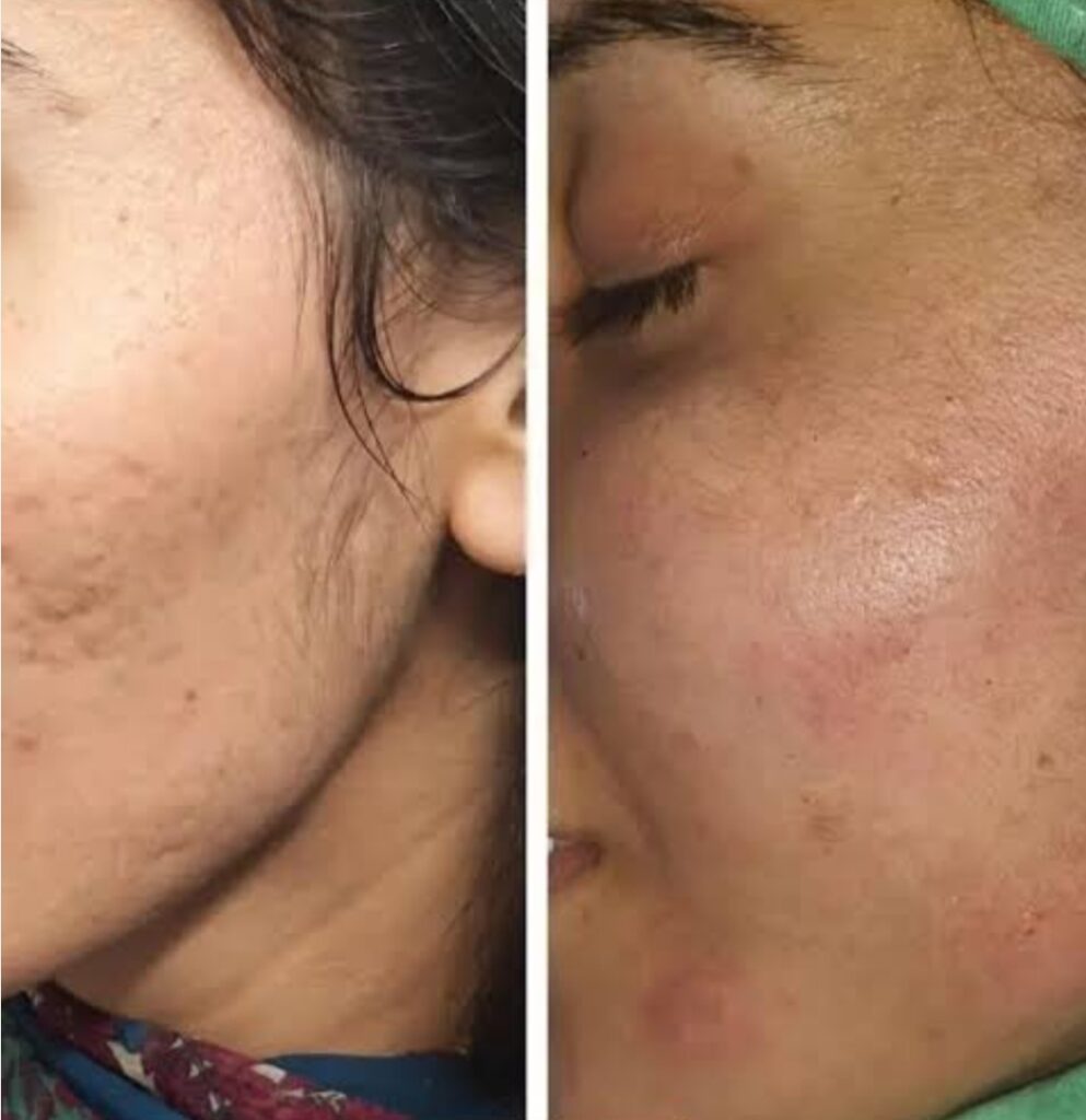 Image #2 from Ameera Naz